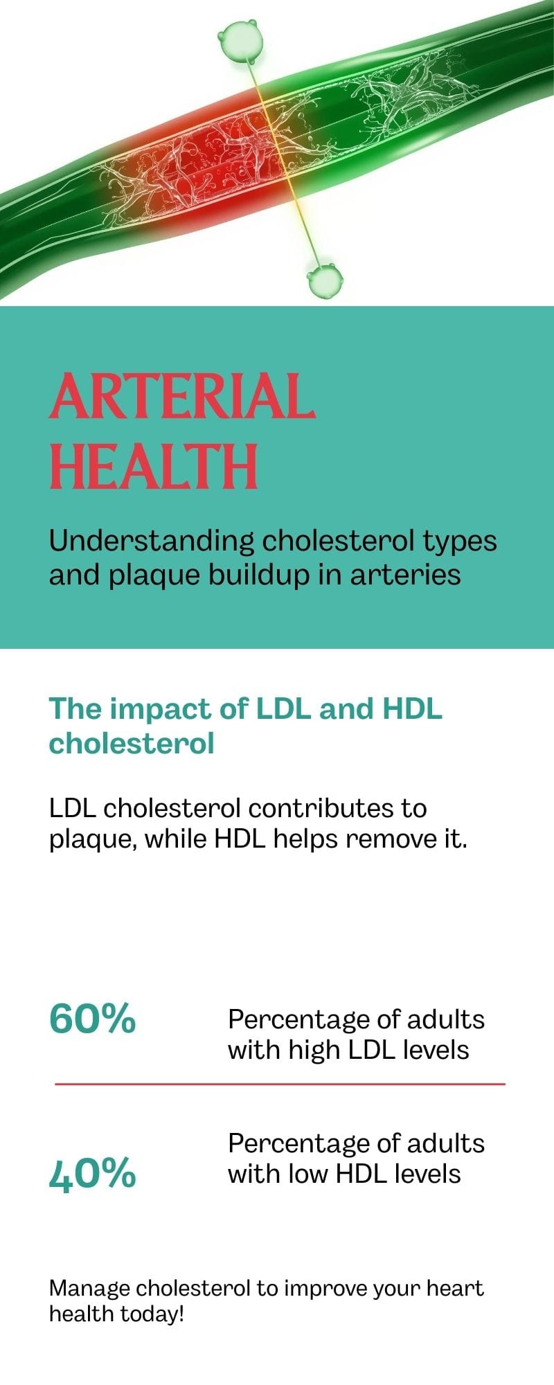 Infographic showing how high LDL cholesterol causes plaque buildup and narrows arteries